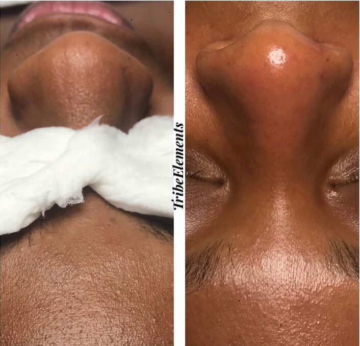 The Glow Facial