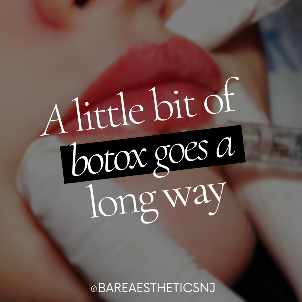 Botox