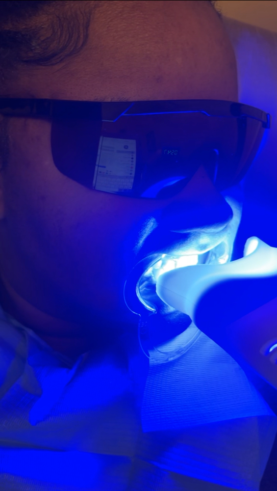 Teeth Whitening
