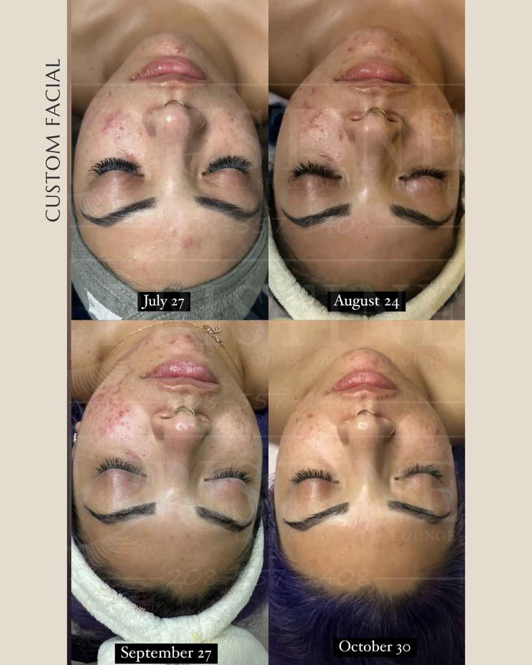 Custom Facial