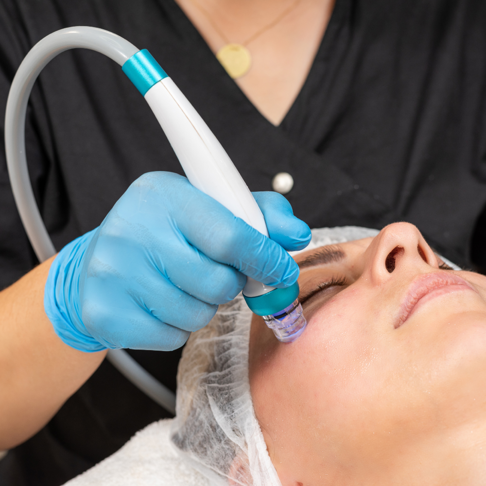 Microdermabrasion Facial