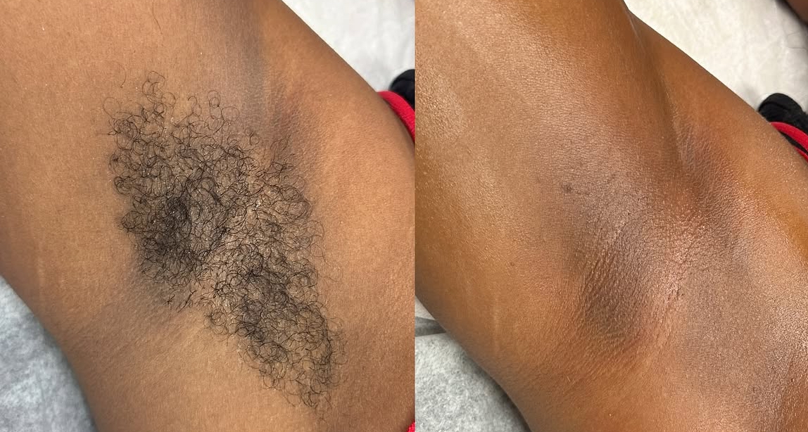Underarm Wax at Jontahontas’ Collection LLC. in Greenville, SC