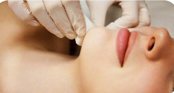 Waxing- Chin