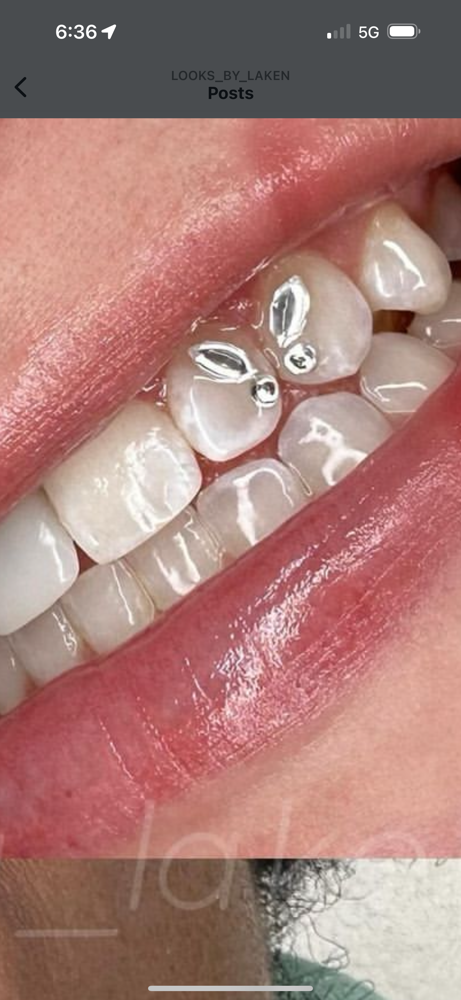 Butterfly Design Tooth Gems