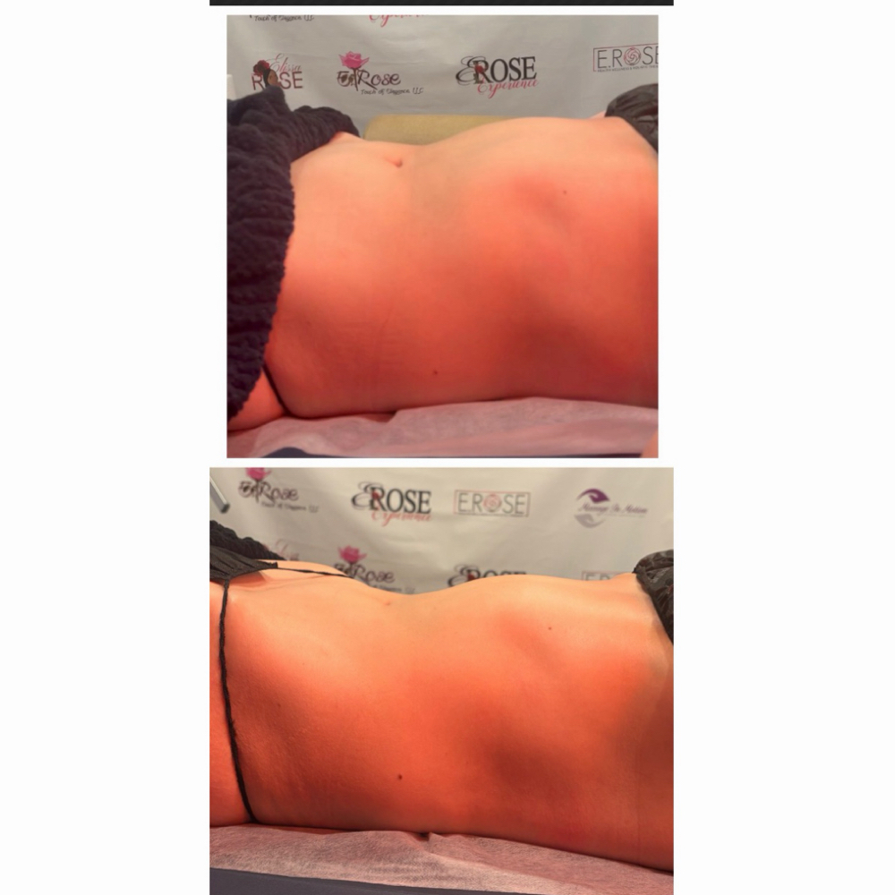 Deep Abdominal Fat Drain Massage at E Rose Health Wellness Holistic Therapy in Southfield, MI