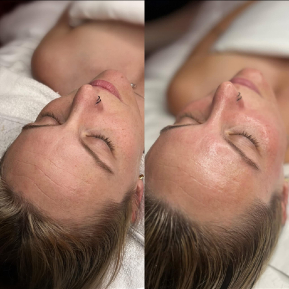 Anti-Aging Facial at Bare Beauty By Alexis in Bay Saint Louis, MS