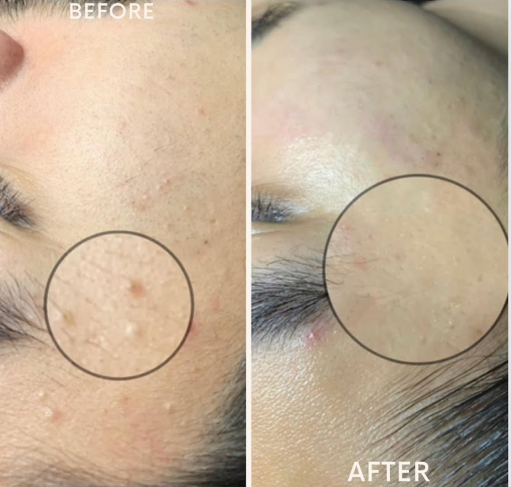 CUSTOMIZED FACIAL