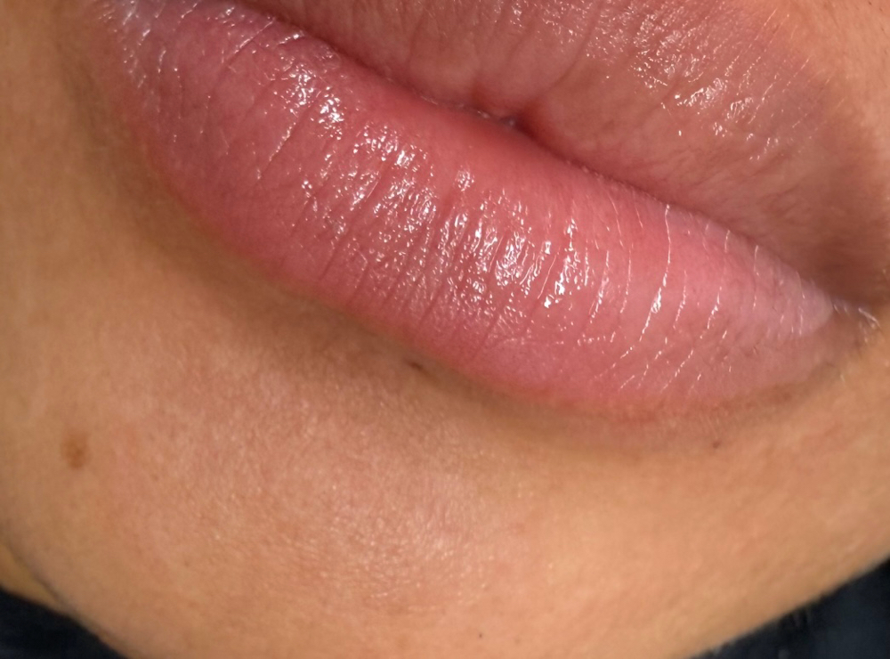 Lower lip