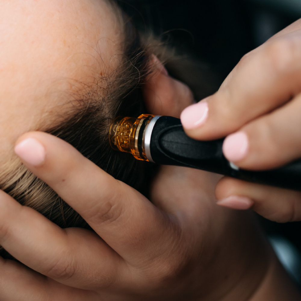 Keravive HydraFacial — Full Scalp at Skin Seed in Turlock, CA