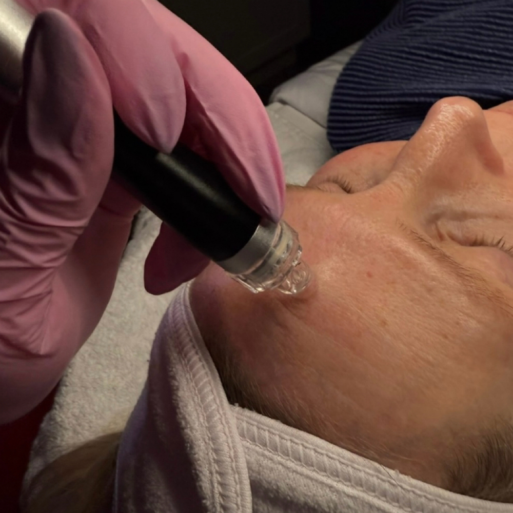 Hydradermabrasion at True Beauty Esthetics in North Platte, NE