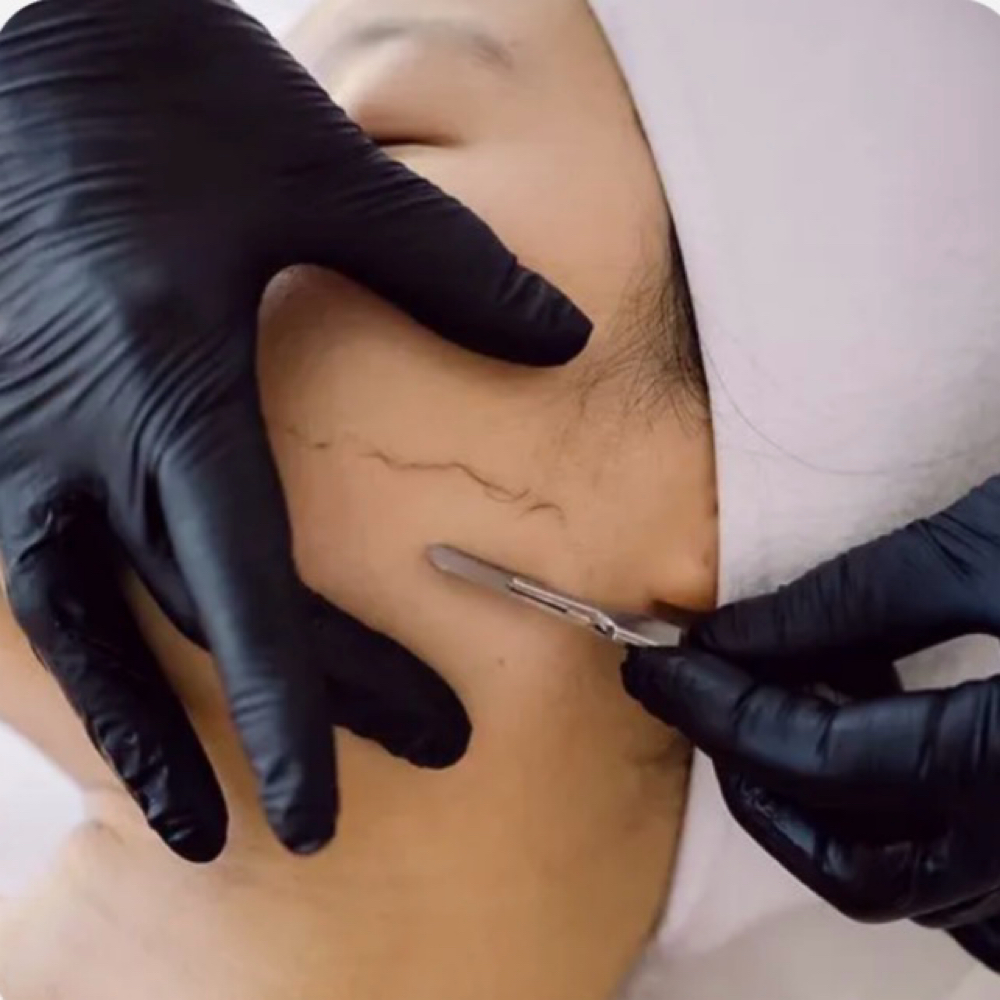 Dermaplane at BeautybyReynaStudio in Goodyear, AZ