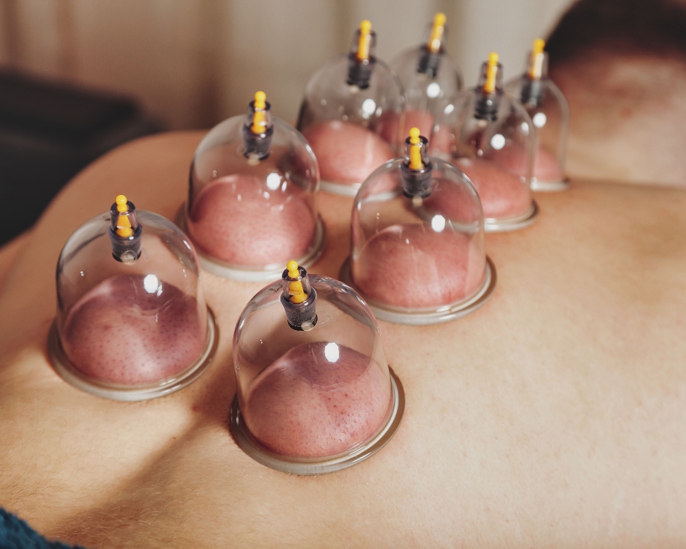 60 Minute Cupping Session