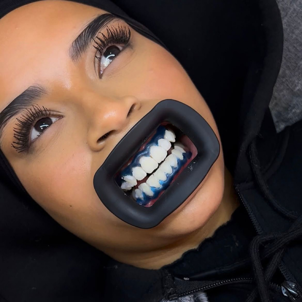 Teeth Whitening at Aesthetics by Amina in New York, NY