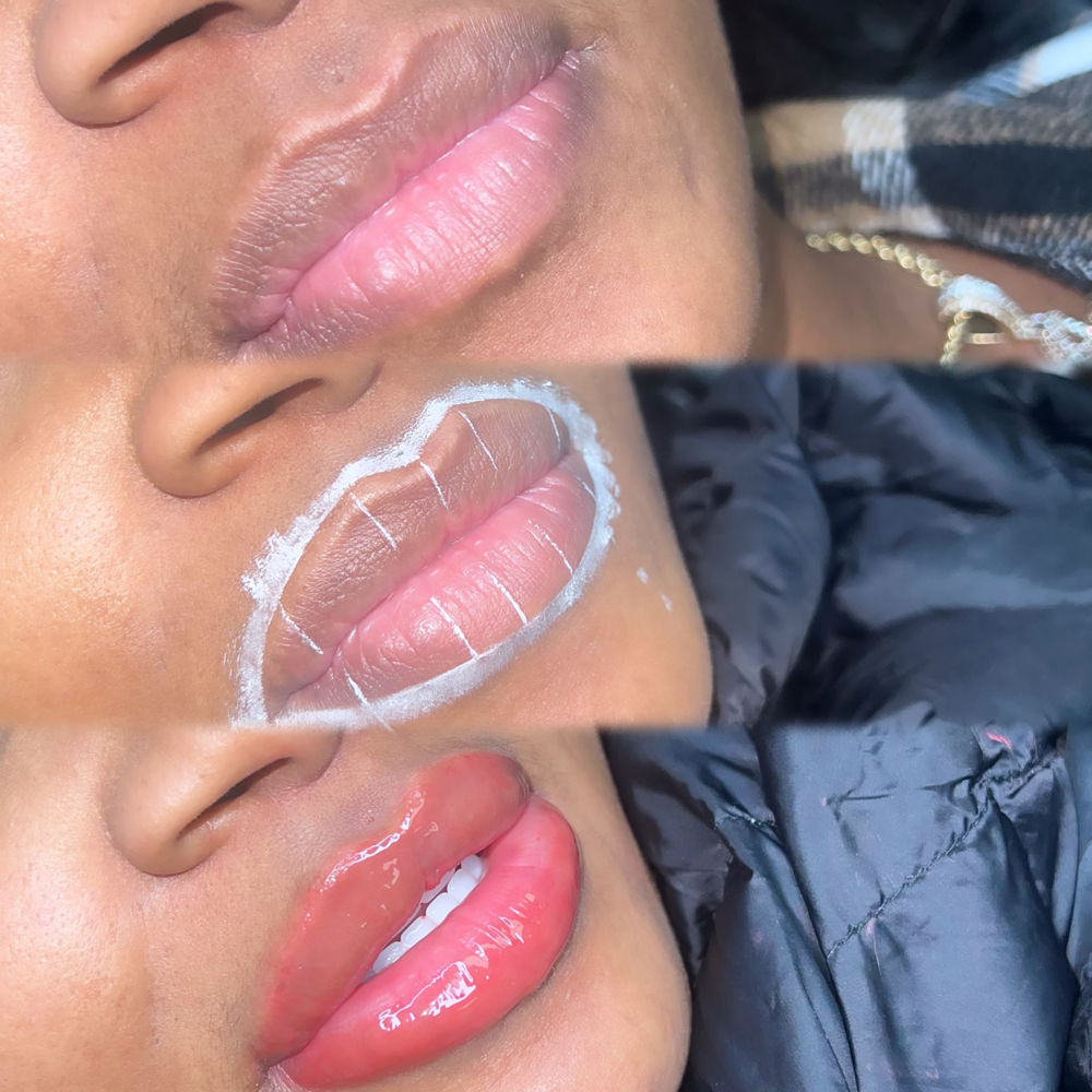 Lip Blush/Neutralization