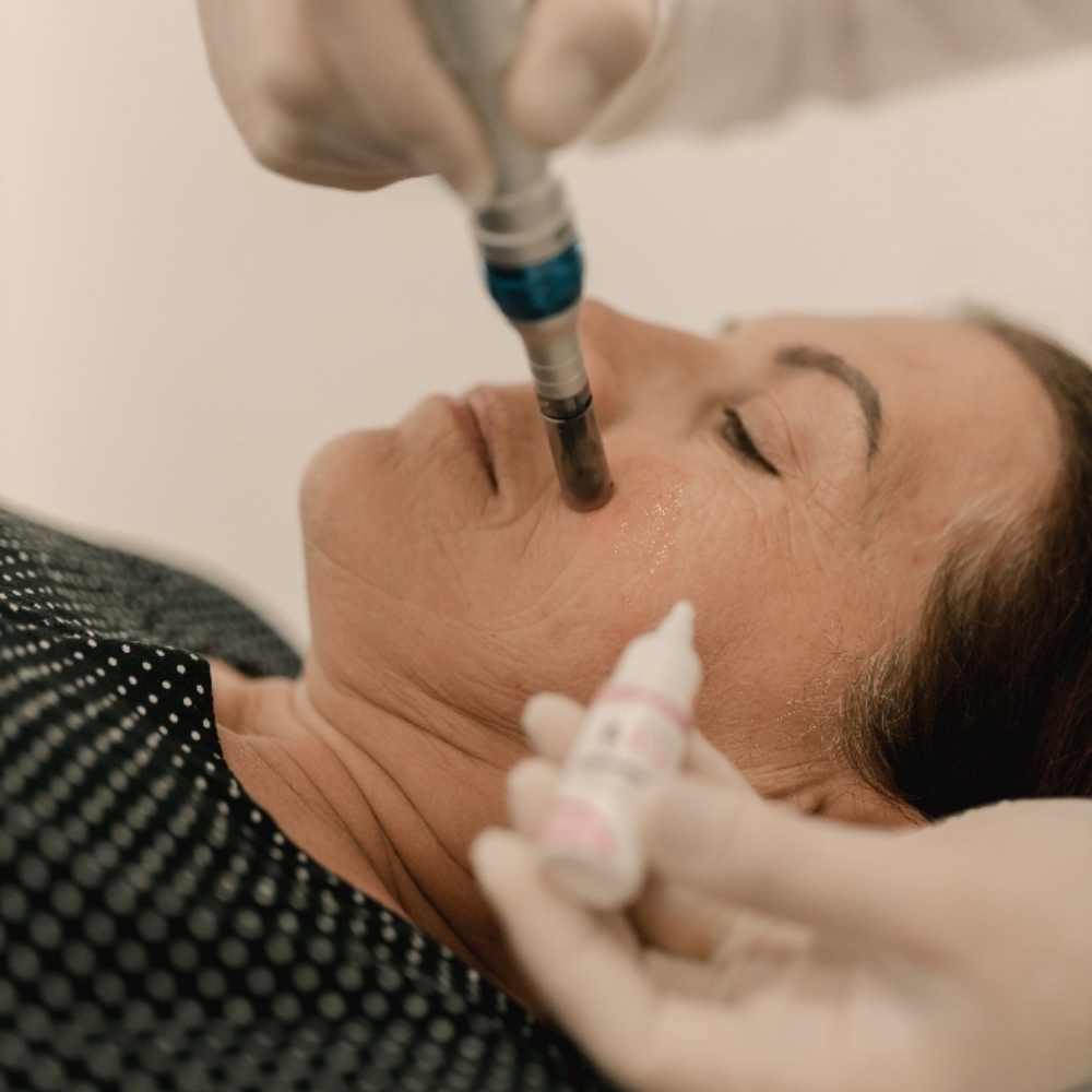 Nano Big Deal at Pore Decisions Esthetics LLC in Hinesville, GA