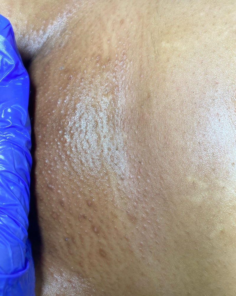 2 Week Touch Up Brazilian