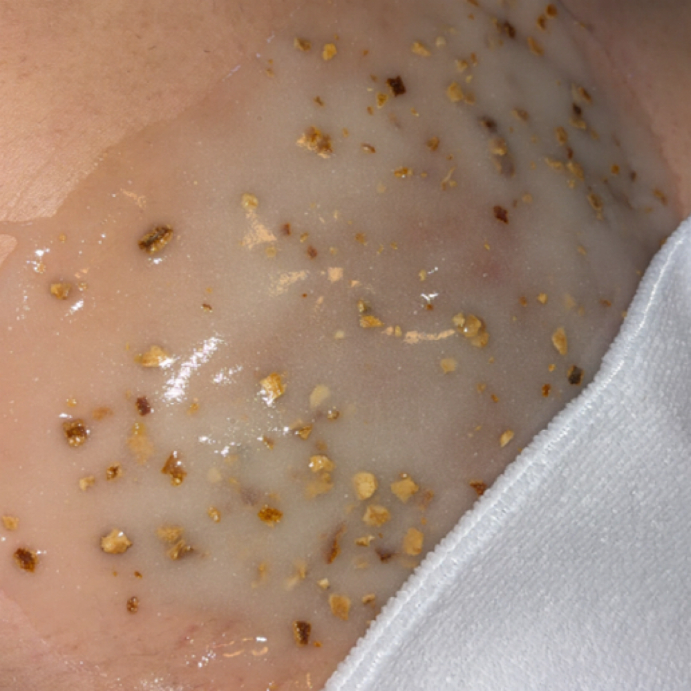 Hydrogel Mask Add-on at You Esthetics in Salem, MA