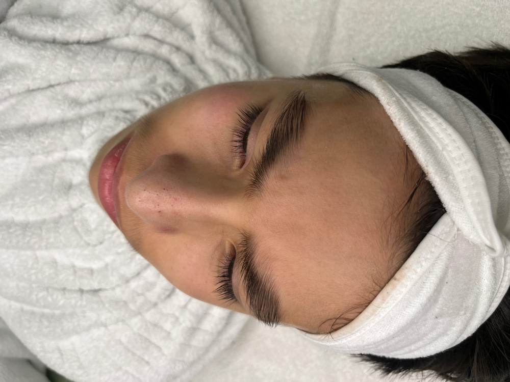 Teen Facial