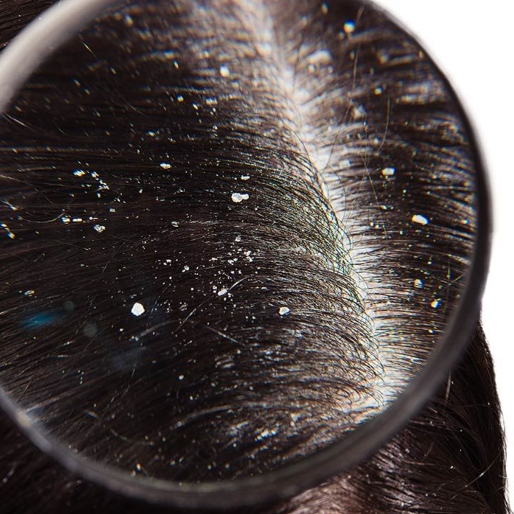 Reviving Scalp Treatment at Brunette + Social in Lewiston, ID