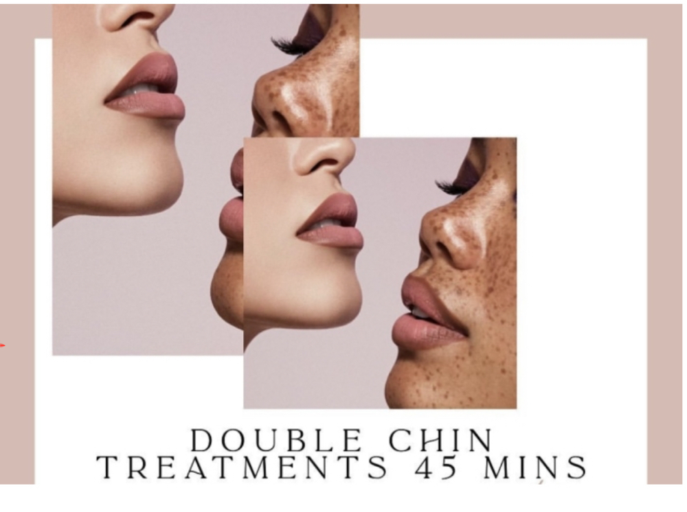 (8) Double Chin Eraser Treatment
