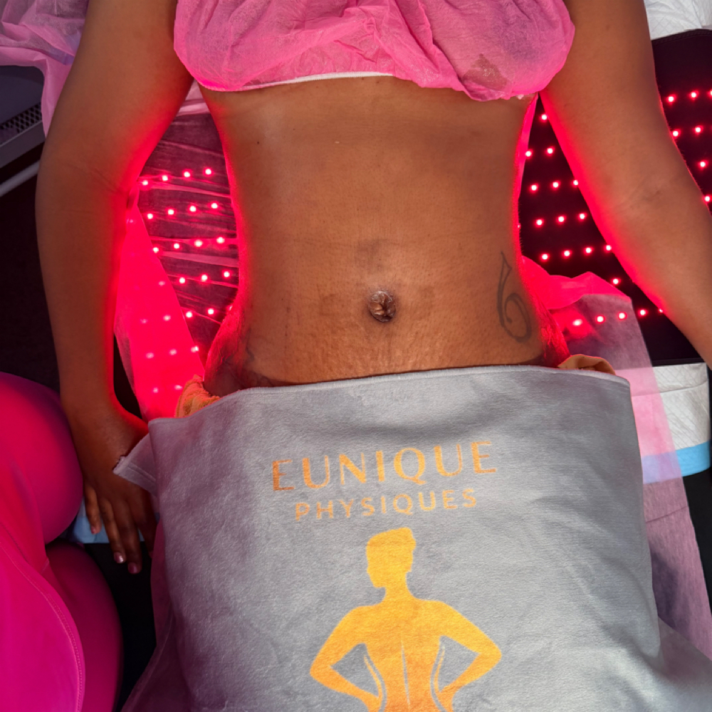 Lymphatic Massage Membership at Eunique Physiques | Post-Op Lymphatic Massage in Toledo, OH