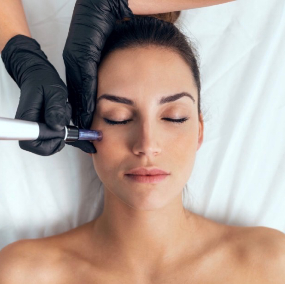 MICRONEEDLING SALMON DNA✨ at NICHÉ in Lewisville, TX