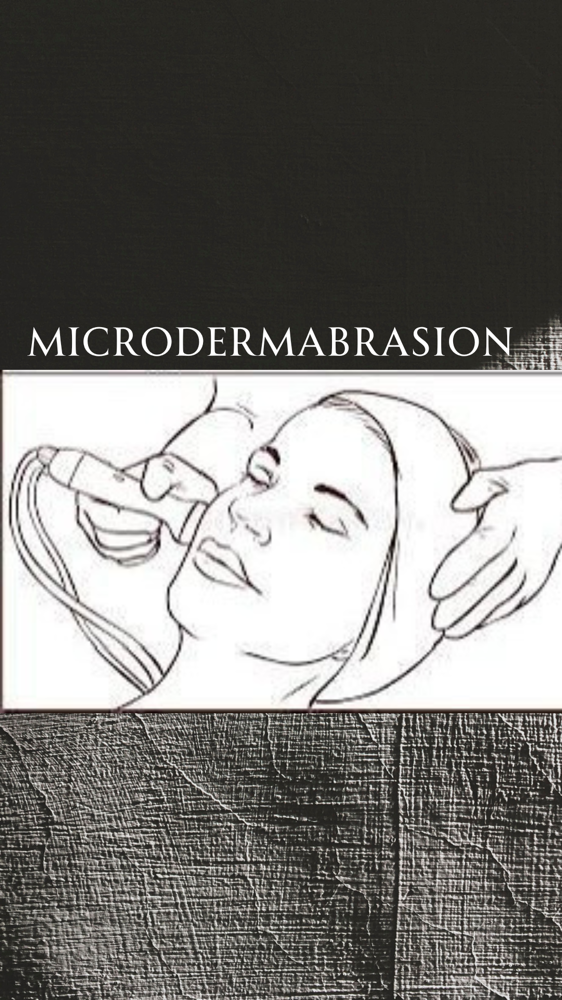 Microdermabrasion