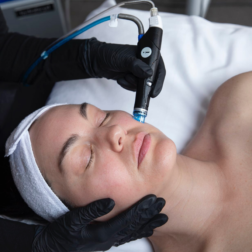 Hydrafacial at Enchanted Esthetics in Yorkville, OH