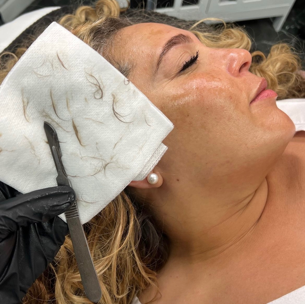 Go & Glow Dermaplane Facial