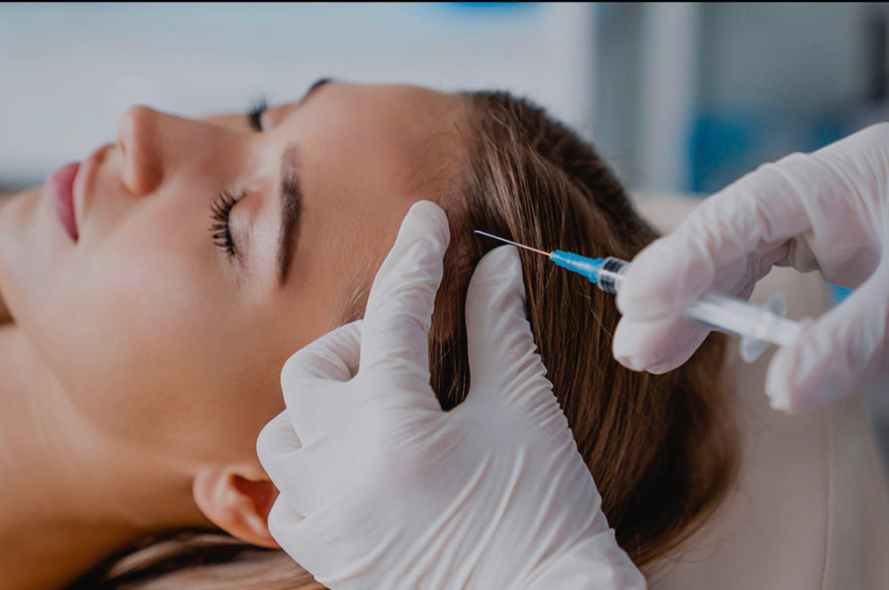 PRP capillary Treatment