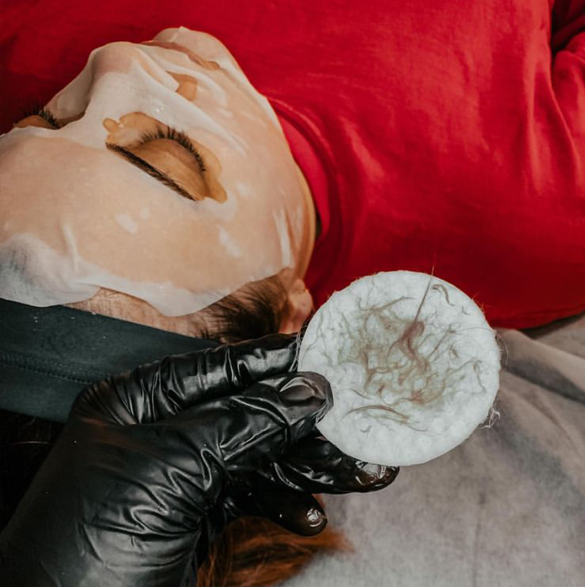 Dermaplaning