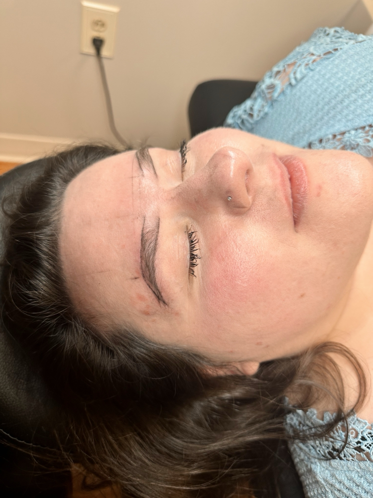 Brow Consultation