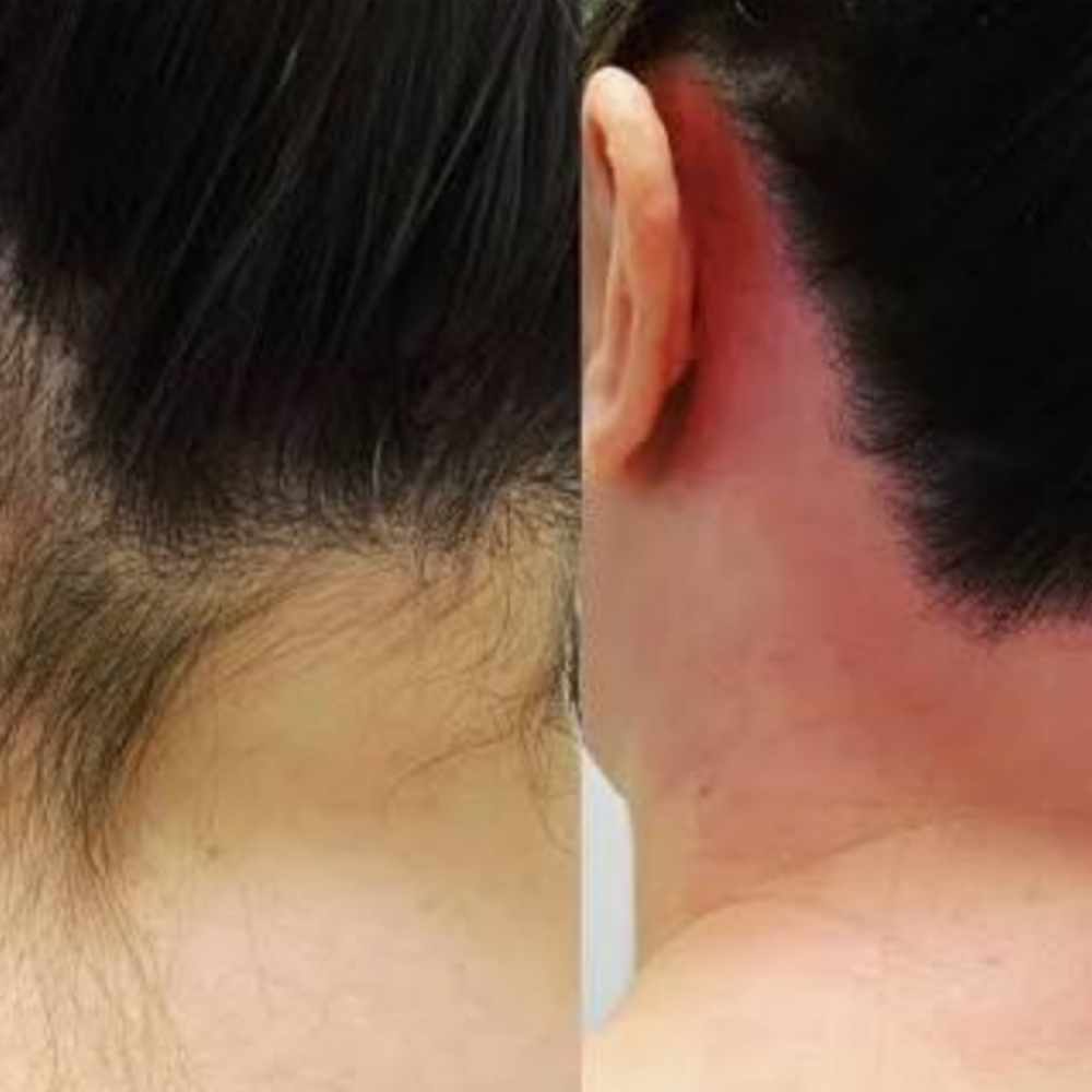 Neck Wax at GetwaxedbyAlma in Salem, OR