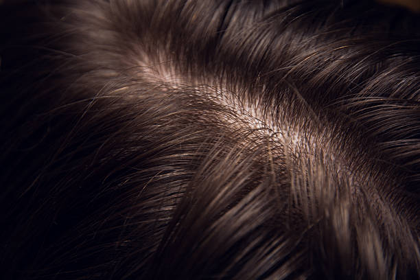 Scalp Detox Treatment