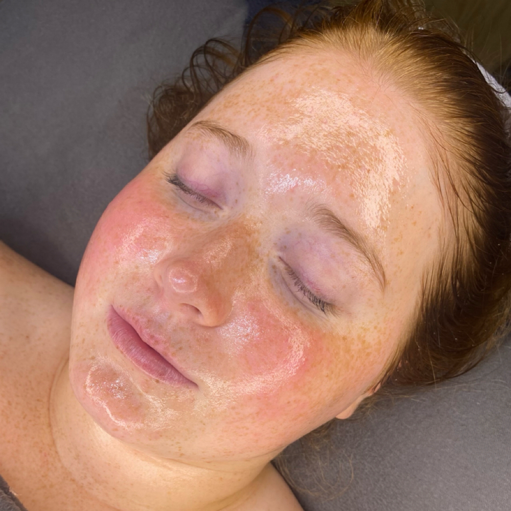 Korean Glass Skin Infusion at Aesthetics by Abby in Alliance, OH