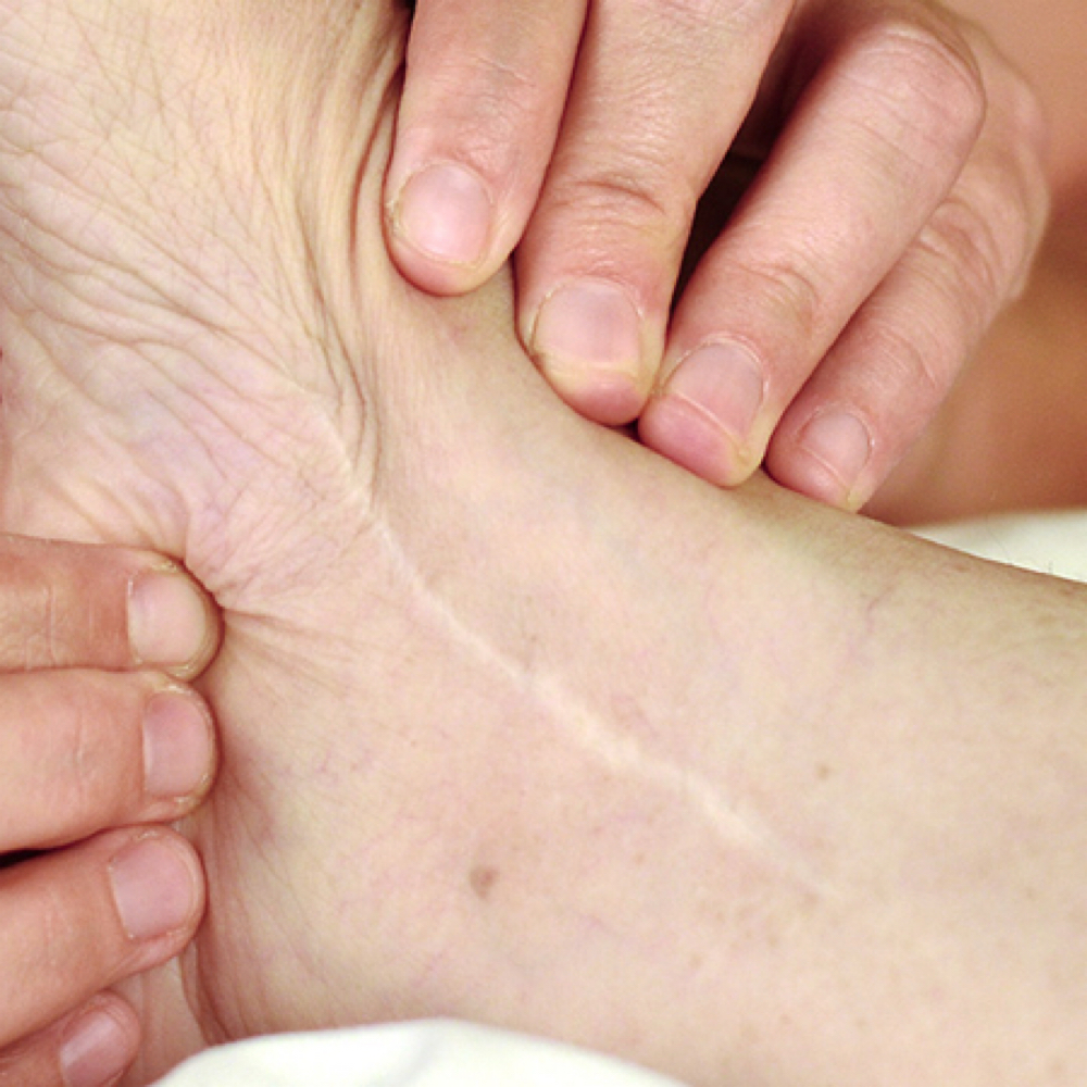 Scar Tissue Release Massage at Savage Massage Therapy in Culpeper, VA