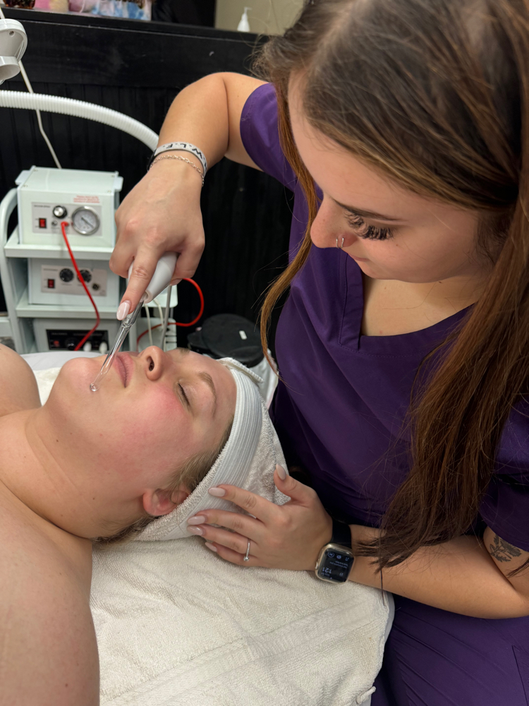 Acne Facial w/ High Frequency at KD ESTHETICS in Lawrenceburg, TN
