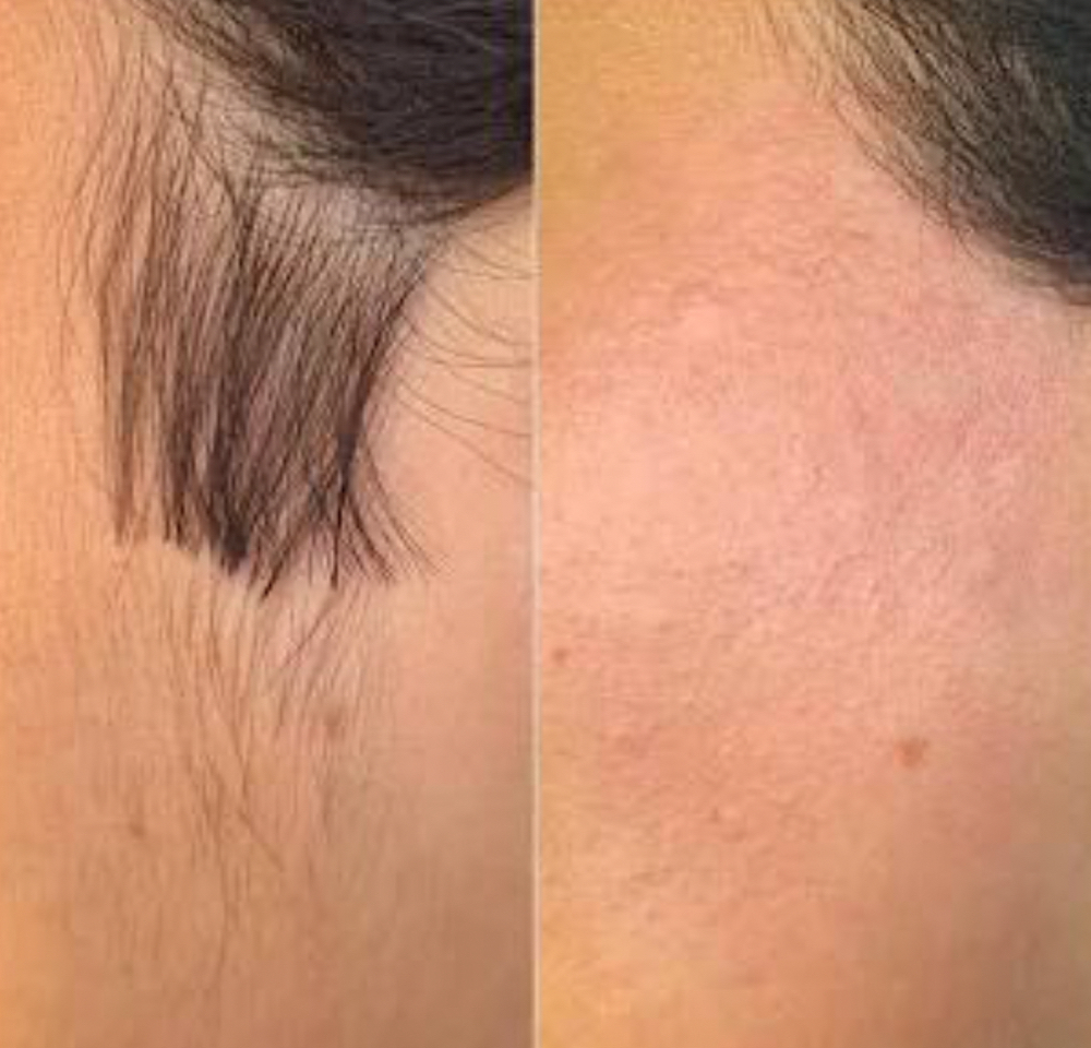 Lexi Sideburn / Face Wax