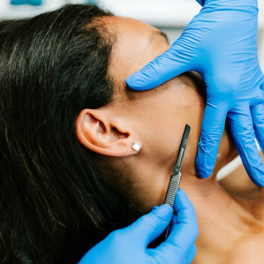 Dermaplaning Facial at The Glow Studio by Lydia in Camas, WA