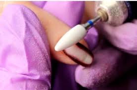 GENTLE Removal & Reapplication
