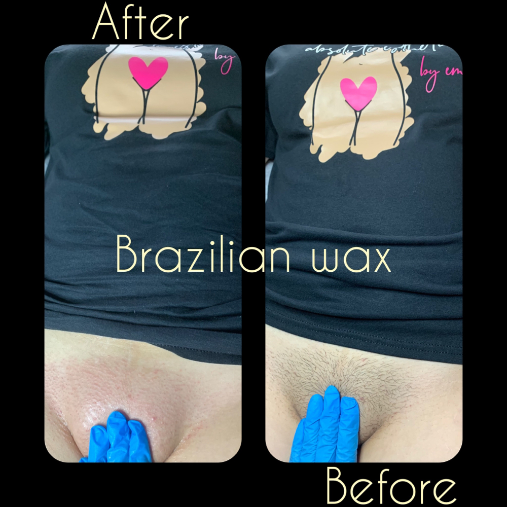 Brazilian 3 Week Clean Up