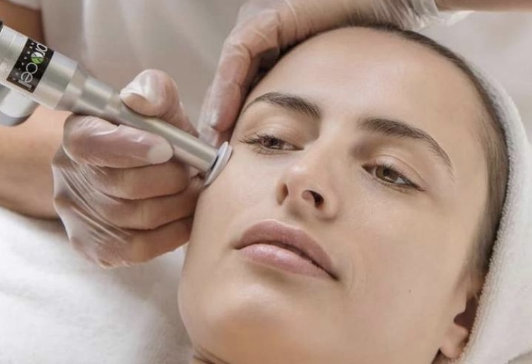 3/ Microneedling Face/Décolleté