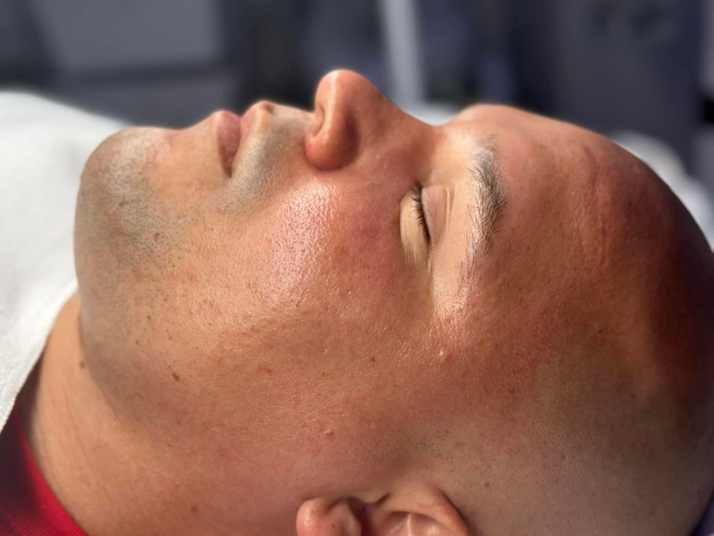 MAN FACIAL