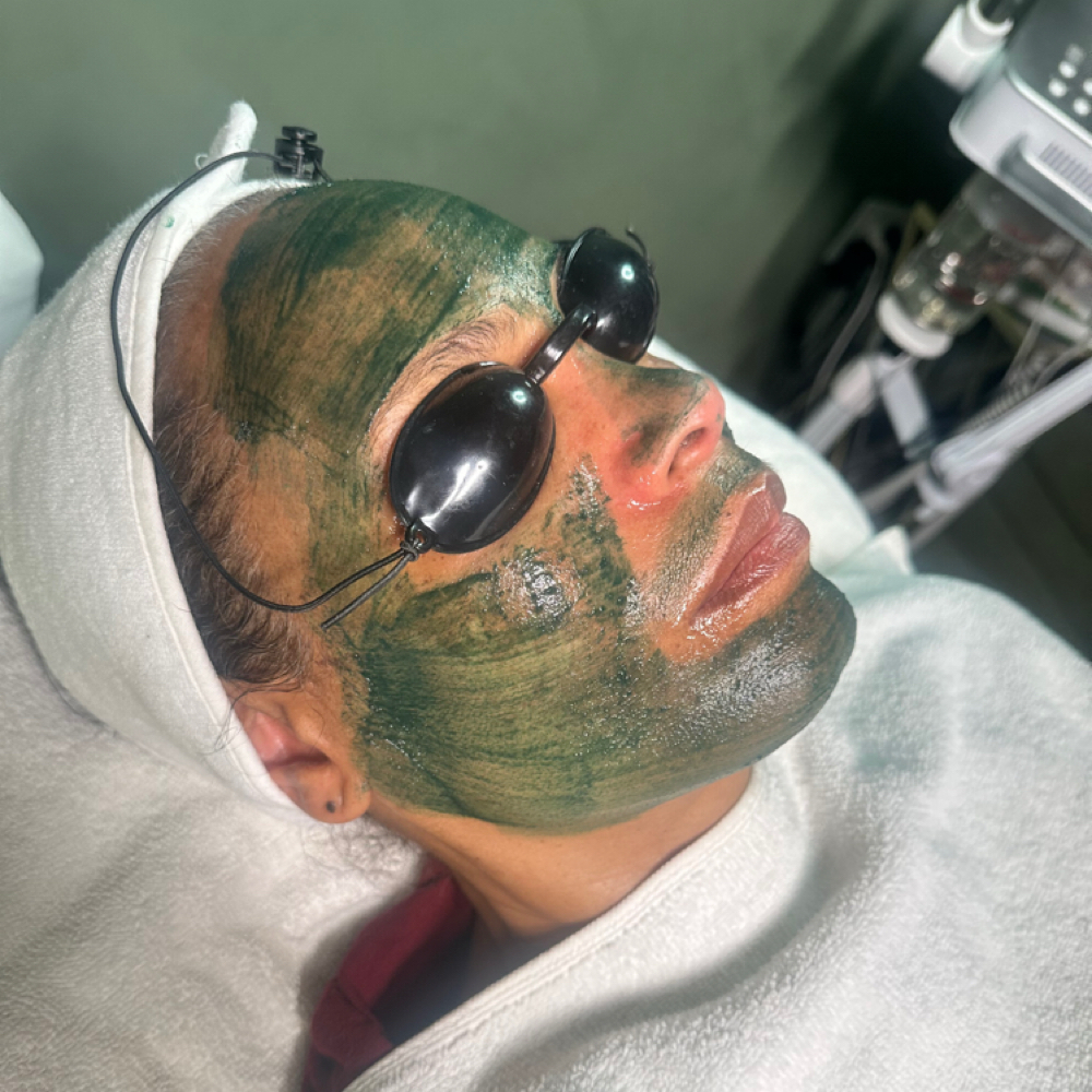 Green Sea Peel at GoodSkin Esthetics in Conshohocken, PA