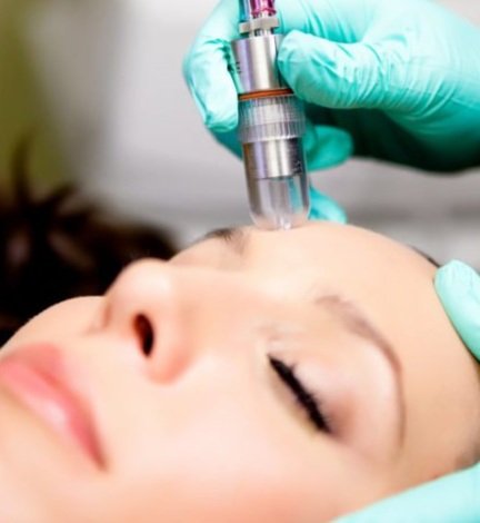 Microdermabrasion