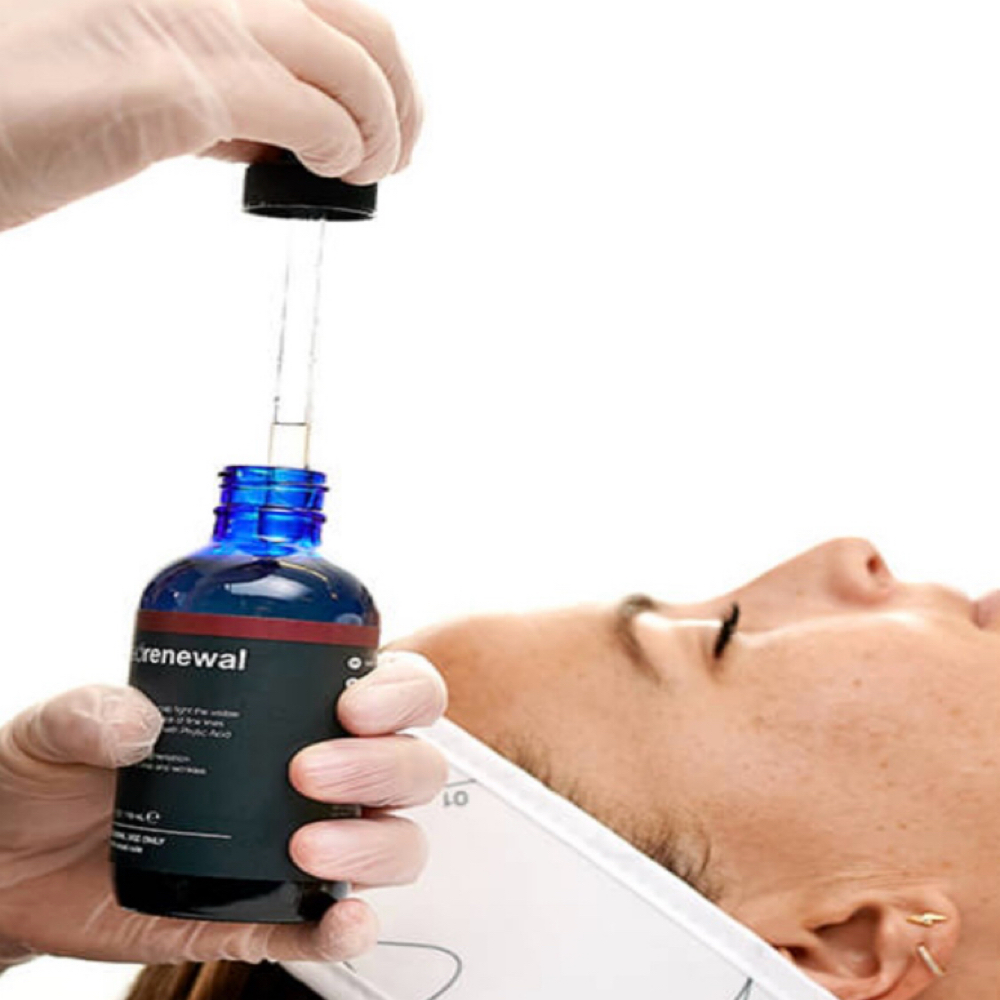 Anti-Aging Chemical Peel at Glass Skin Studio in West Bloomfield, MI