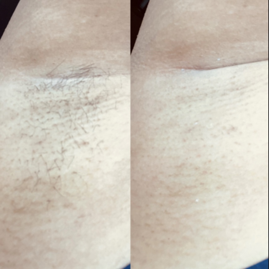 Underarm Wax