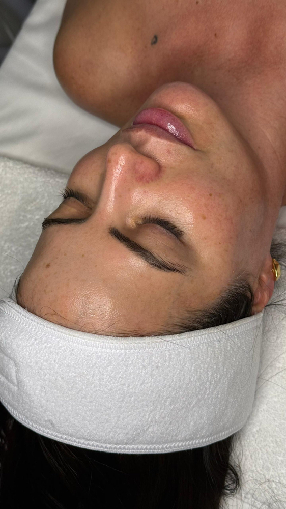 Dermawheel