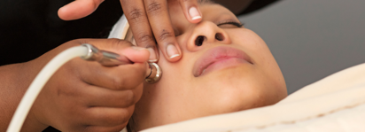 Microdermabrasion