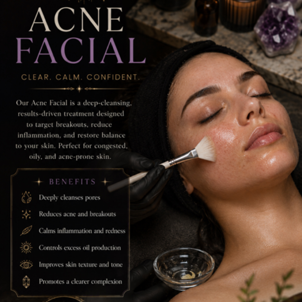 Acne Facial at The Skin Apothecary in Baytown, TX